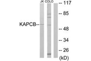 Western blot analysis of extracts from Jurkat/COLO205 cells, using KAPCB Antibody.