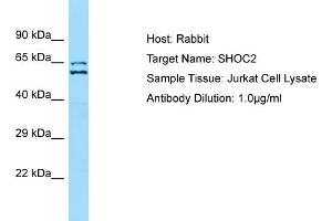 Host: RabbitTarget Name: SHOC2Antibody Dilution: 1. (SHoc2/Sur8 anticorps  (N-Term))