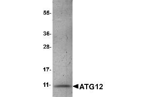 Western Blotting (WB) image for Autophagy Related 12 (ATG12) (AA 101-141) protein (His tag) (ABIN2468250)