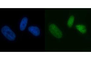 IF analysis of MCM7 using anti-MCM7 antibody (ABIN7601968). (MCM7 anticorps  (AA 526-719))