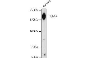 Western blot analysis of extracts of Rat lung, using THBS1 antibody (ABIN3022978, ABIN3022979, ABIN3022980 and ABIN6219329) at 1:500 dilution.