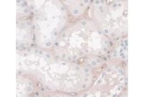 DAB staining on IHC-P; Samples: Human Kidney Tissue. (HPR anticorps  (AA 70-332))