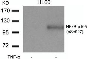 Western blot analysis of extracts from HL60 cells untreated or treated with TNF-a using NFkB-p105(Phospho-Ser927) Antibody. (NFKB1 anticorps  (pSer927))