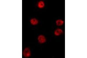 ABIN6275322 staining HepG2 by IF/ICC. (NRBF2 anticorps  (Internal Region))