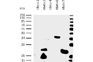 Presence of sIgE antibodies specific to recombinant allergens Bet v 1, Bet v 2, Bet v 4, Bet v 6, and Bet v 7 was analysed in plasma of a patient with confirmed presence (routine clinical test) of specific IgE antibodies to birch pollen allergen extract. (Bet v 7 (Betula Verrucosa) Protéine)