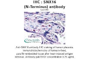 Image no. 2 for anti-Sorting Nexin 16 (SNX16) (N-Term) antibody (ABIN1739488) (SNX16 anticorps  (N-Term))