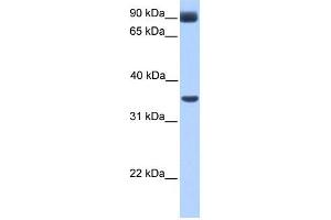 WB Suggested Anti-CIR Antibody Titration:  0. (KCNJ5 anticorps  (Middle Region))