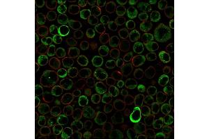 Paraformaldehyde-fixed Raji cells stained with Double Stranded DNA Mouse Monoclonal Antibody (121-3)followed by Goat anti-Mouse IgG-CF488 (Green). (dsDNA anticorps)