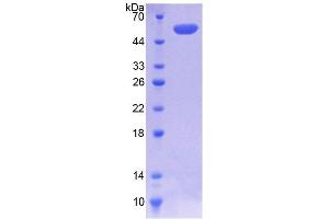 SDS-PAGE analysis of Human COQ6 Protein.