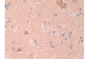 DAB staining on IHC-P; Samples: Human Cerebrum Tissue