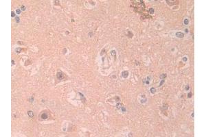 DAB staining on IHC-P; Samples: Human Cerebrum Tissue (IL1RAPL2 anticorps  (AA 161-330))