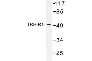 Image no. 1 for anti-Thyrotropin-Releasing Hormone Receptor (TRHR) antibody (ABIN317876) (TRHR anticorps)