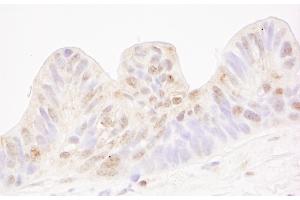 Immunohistochemistry (IHC) image for anti-Methyl-CpG Binding Domain Protein 4 (MBD4) (AA 1-50) antibody (ABIN7448644) (MBD4 anticorps  (AA 1-50))