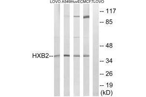 Western blot analysis of extracts from LOVO cells, A549 cells, HUVEC cells and MCF-7 cells, using HOXB2 antibody. (HOXB2 anticorps)