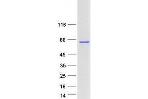 Validation with Western Blot