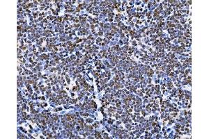 IHC analysis of BUB1 using anti-BUB1 antibody (ABIN7600942). (BUB1 anticorps  (AA 26-1085))
