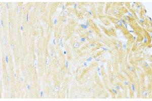 Immunohistochemistry of paraffin-embedded Mouse heart using UQCC2 Polyclonal Antibody at dilution of 1:100 (40x lens). (MNF1 anticorps)