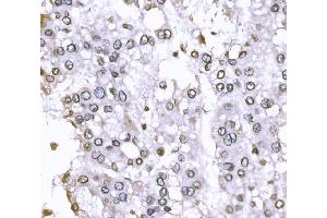 IHC analysis of SUN2 using anti-SUN2 antibody (ABIN7601278). (SUN2 anticorps  (AA 31-695))