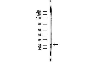 anti-Zinc Finger Protein 230 (ZNF230) (Internal Region) antibody
