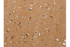 The image on the left is immunohistochemistry of paraffin-embedded Human brain tissue using ABIN7128941(CHRNA4 Antibody) at dilution 1/20, on the right is treated with fusion protein. (CHRNA4 anticorps)