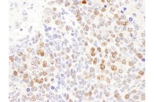 Immunohistochemistry (IHC) image for anti-Deoxycytidine Kinase (DCK) (AA 210-260) antibody (ABIN7453430) (DCK anticorps  (AA 210-260))