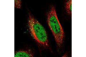 Immunofluorescent staining of human cell line U-2 OS with PRCC polyclonal antibody  at 1-4 ug/mL dilution shows positivity in nucleus but not nucleoli and vesicles.