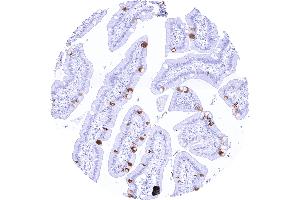 Duodenal mucosa with a moderate to strong TFF1 positivity of selected goblet cells