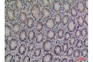 Immunohistochemistry (IHC) analysis of paraffin-embedded Human Colon, antibody was diluted at 1:100.