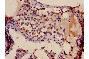 Immunohistochemistry of paraffin-embedded human testis tissue using ABIN7172499 at dilution of 1:100 (TFDP3 anticorps  (AA 61-196))