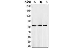 Western blot analysis of SMAD6 expression in A204 (A), LN18 (B), L929 (C) whole cell lysates. (SMAD6 anticorps  (Center))