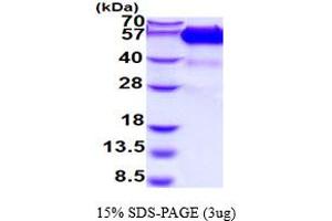 SDS-PAGE (SDS) image for Tumor Necrosis Factor Receptor Superfamily, Member 1A (TNFRSF1A) (AA 30-211) protein (hIgG-His-tag) (ABIN5854547)