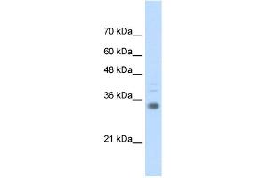 WB Suggested Anti-HOXB4 Antibody Titration:  0.