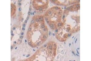 Used in DAB staining on fromalin fixed paraffin- embedded Kidney tissue