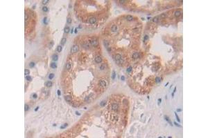 Used in DAB staining on fromalin fixed paraffin- embedded Kidney tissue (PRDM14 anticorps  (AA 395-568))