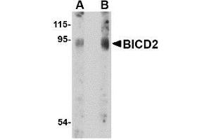 Western blot analysis of BICD2 in A549 cell lysate with AP30145PU-N BICD2 antibody at (A) 1 and (B) 2 μg/ml. (BICD2 anticorps  (C-Term))