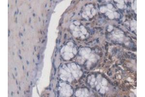 IHC-P analysis of Mouse Colon Tissue, with DAB staining.