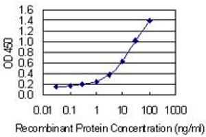 Detection limit for recombinant GST tagged PLS3 is 0. (Plastin 3 anticorps  (AA 1-630))