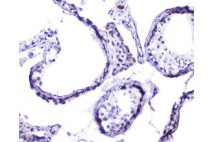 IHC analysis of Hsp105 using anti-Hsp105 antibody (ABIN5693036). (HSPH1 anticorps  (AA 653-858))