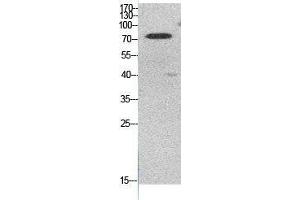 Western Blot (WB) analysis of HeLa cells using Acetyl-Ub (K48) Polyclonal Antibody.