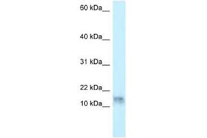 Western Blot showing DNAL1 antibody used at a concentration of 1 ug/ml against HepG2 Cell Lysate (DNAL1 anticorps  (N-Term))