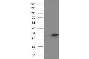 Western Blotting (WB) image for anti-Eukaryotic Translation Initiation Factor 4E Family Member 2 (EIF4E2) antibody (ABIN1497993) (EIF4E2 anticorps)