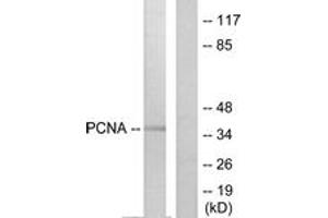 Western blot analysis of extracts from HepG2 cells, using PCNA Antibody. (PCNA anticorps  (AA 61-110))