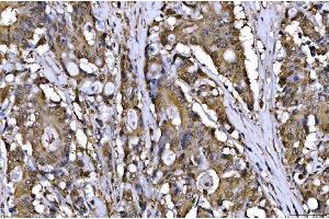 IHC analysis of AHA1/AHSA1 using anti-AHA1/AHSA1 antibody (ABIN7600708). (AHSA1 anticorps  (AA 221-264))
