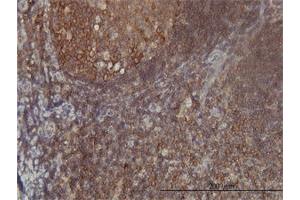 Immunoperoxidase of monoclonal antibody to FARSLB on formalin-fixed paraffin-embedded human tonsil tissue.