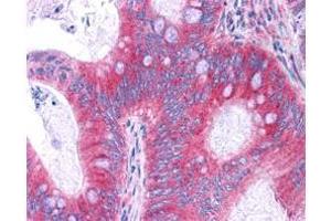 Antibody  has been tested in immunohistochemistry, analyzed by an anatomic pathologist and validated for use in IHC applications against formalin-fixed, paraffin-embedded human tissues.