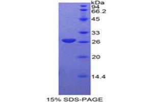 SDS-PAGE analysis of Cow Cyclin D1 Protein. (Cyclin D1 Protein (CCND1))