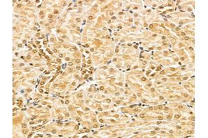 ABIN7094351 and ABIN7098398 at 1/100 staining Rat kidney tissue by IHC-P.
