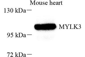 Western blot analysis of MYLK3 (ABIN7074736) at dilution of 1: 800