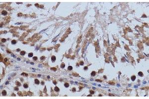 Immunohistochemistry of paraffin-embedded Rat testis using BRD4 Polyclonal Antibody at dilution of 1:100 (40x lens). (BRD4 anticorps)