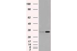 Image no. 5 for anti-Proto-Oncogene Pim-2 (Serine Threonine Kinase) (PIM2) antibody (ABIN1500220)